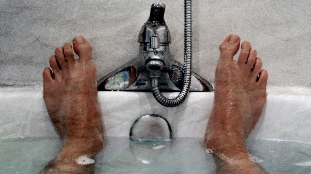 The feet of someone with anal swelling soaking in a bath.-2