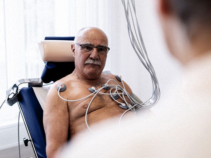 Atrial fibrillation: Early onset AFib may increase dementia risk - Vimarsana News