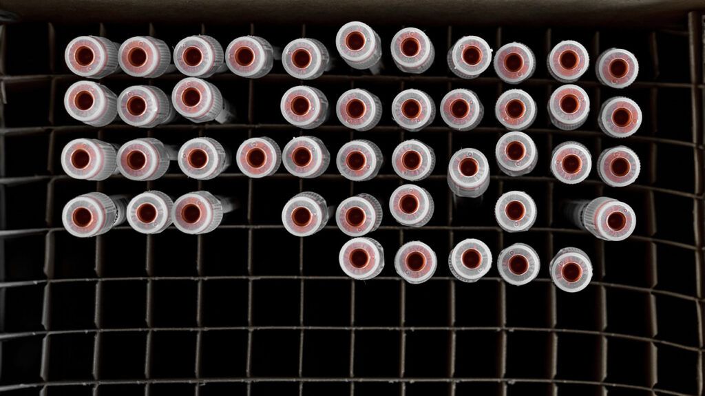 A top-down view of several vials containing blood samples