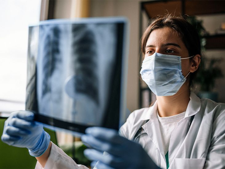 Ground glass opacity Causes, symptoms, and treatments