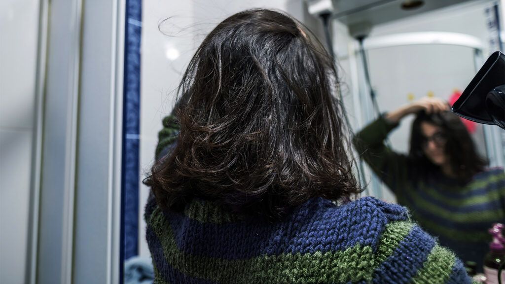 A woman looking in the mirror to identify signs of rosacea on the scalp -1.