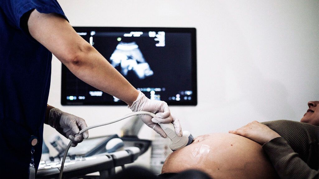A medical professional is performing an ultrasound on a pregnant person.