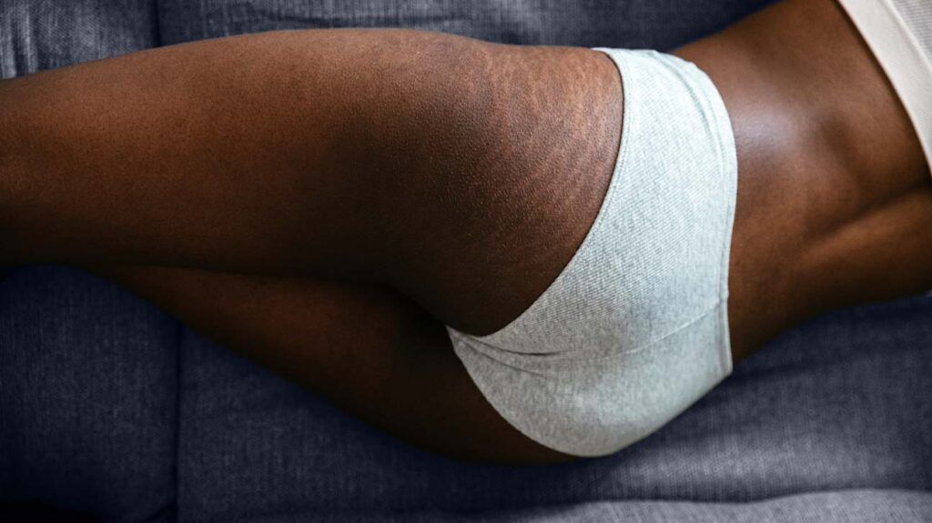 The lower half of a body wearing white underpants to represent butt rash -1.