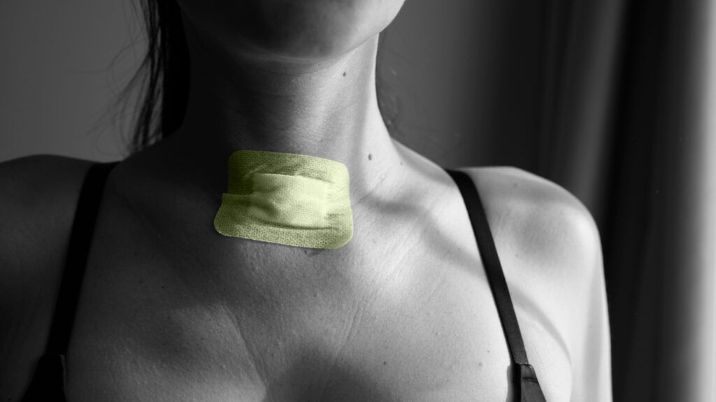 Close-up of a woman's upper body with a wound dressing on her neck.
