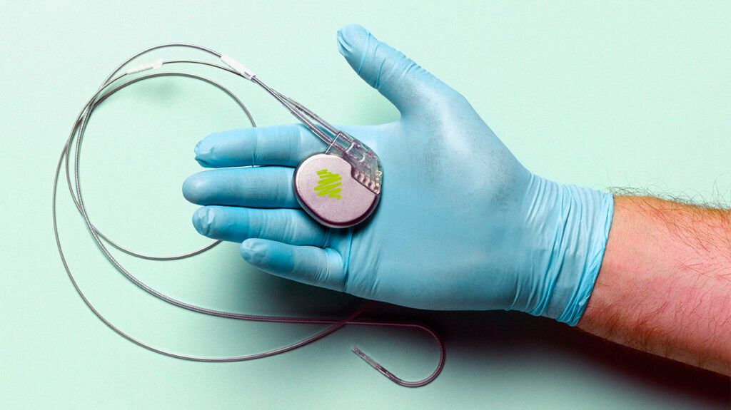 Heart pacemaker in cardiologist's hand.