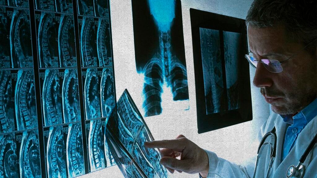 Doctor checking X-rays