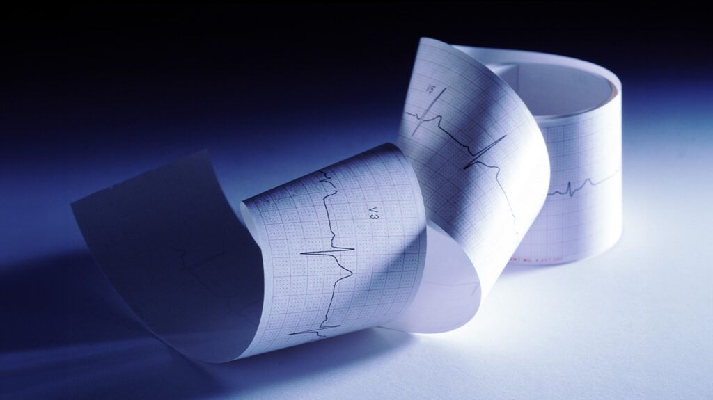 A curled strip of paper with an EKG reading on it.