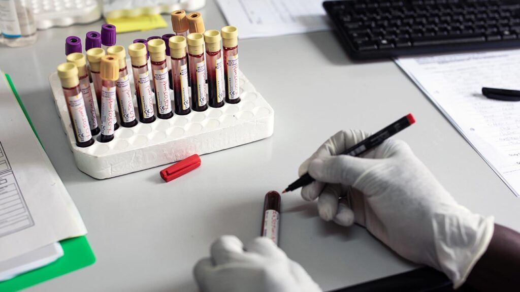 photo showing vials of blood samples and someone's gloved hands holding a pen