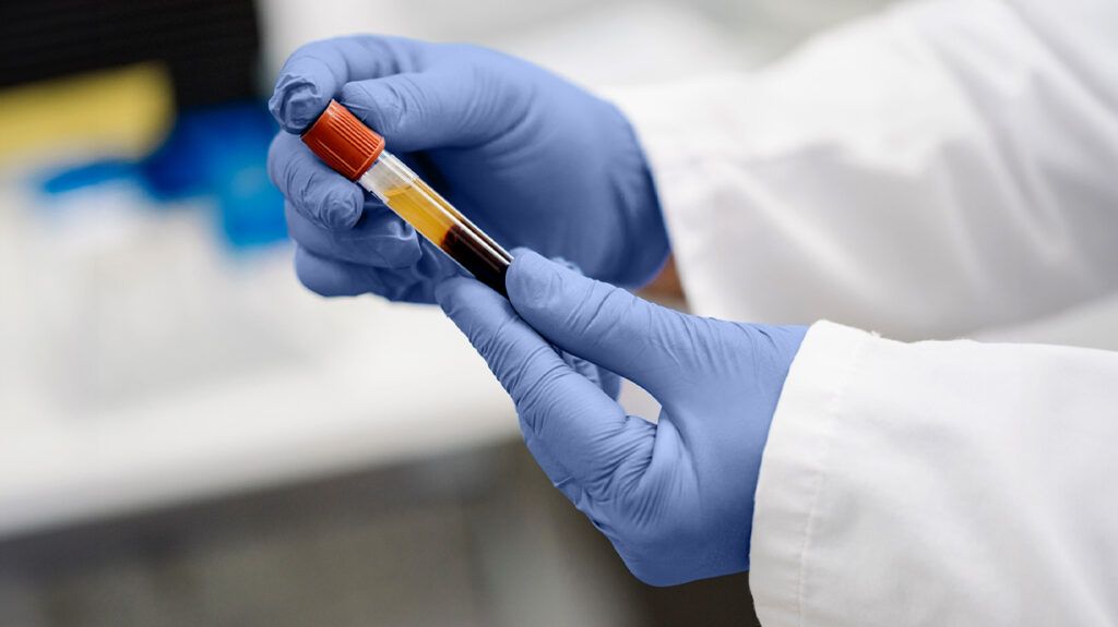 A lab technician preparing a blood sample-1.