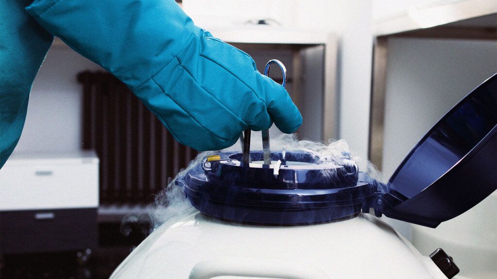 A doctor placing a sample into a cold cannister when using cryoablation to treat AFib.-2