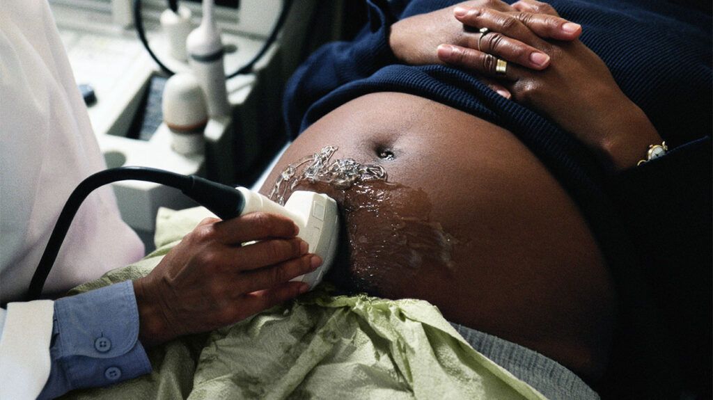 A pregnant woman getting an ultrasound scan to look for cystic fibrosis in a fetus. -1 