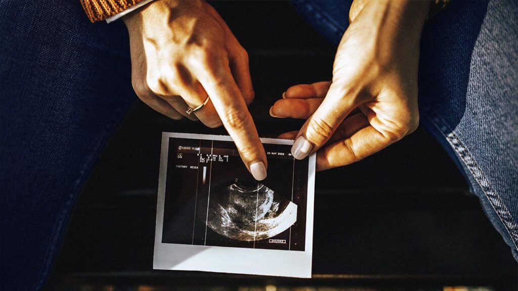 Person pointing to an ultrasound image