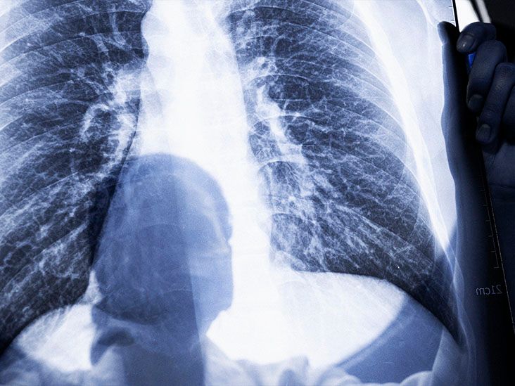 9 causes of pain in the right upper quadrant of the ribs