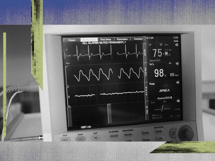 Tachycardia vs. bradycardia Symptoms, causes, and more