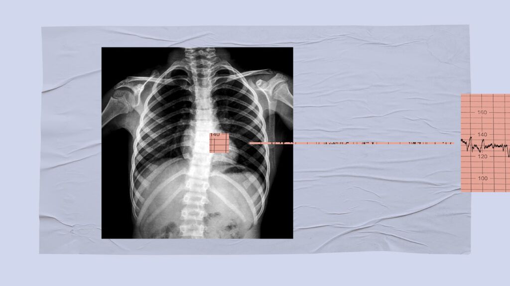 A medical image of someone's chest.-1