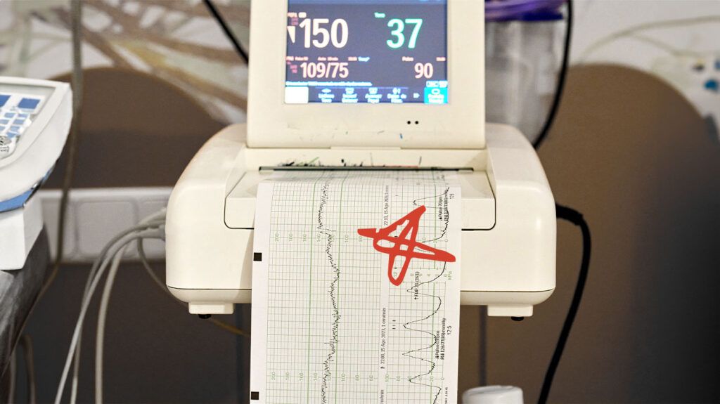 A heart monitor screen -1.