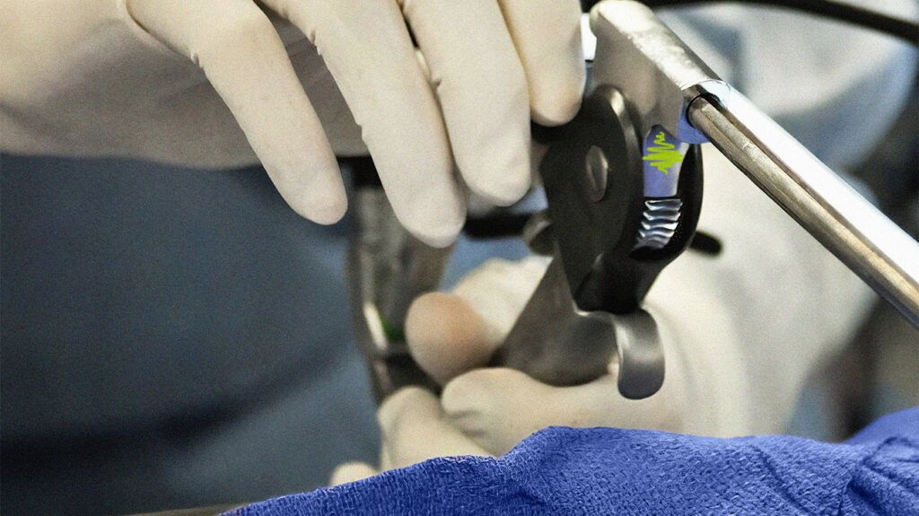 A doctor's hands performing a laryngoscopy.-2