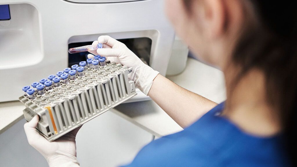 A medical professional examines a tray of blood vials