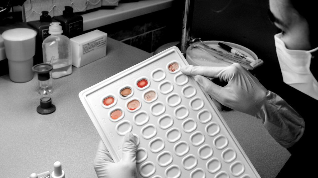 A lab technician looks at a blood test panel