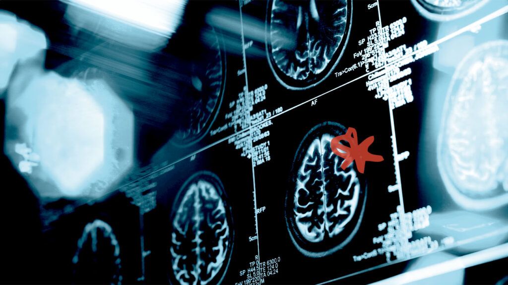 Images de scanners électroniques du cerveau