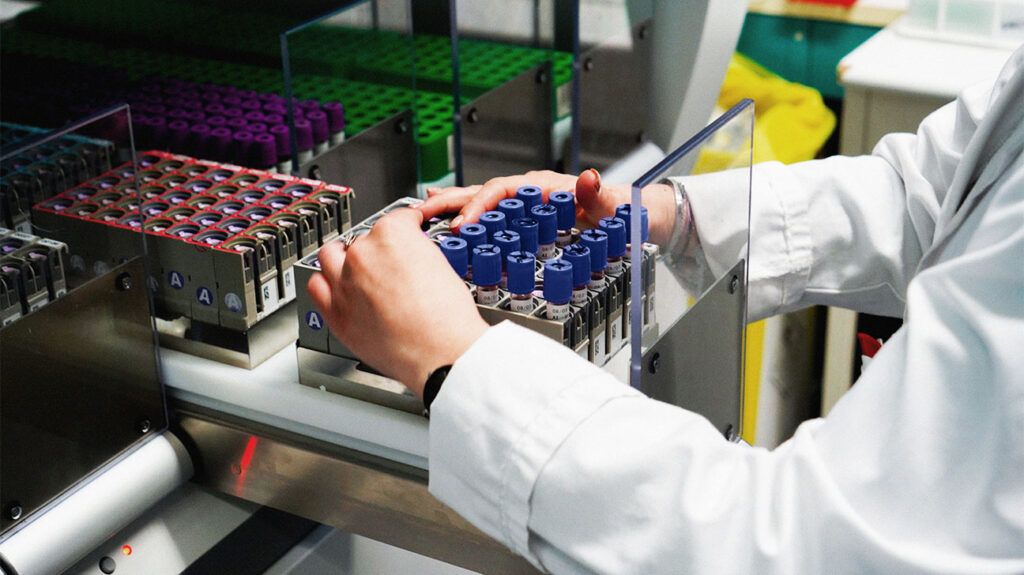 A laboratory worker handling vials of blood-1