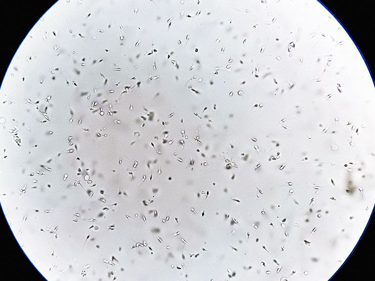 Le microbiome du sperme lié à l’infertilité masculine, selon une étude