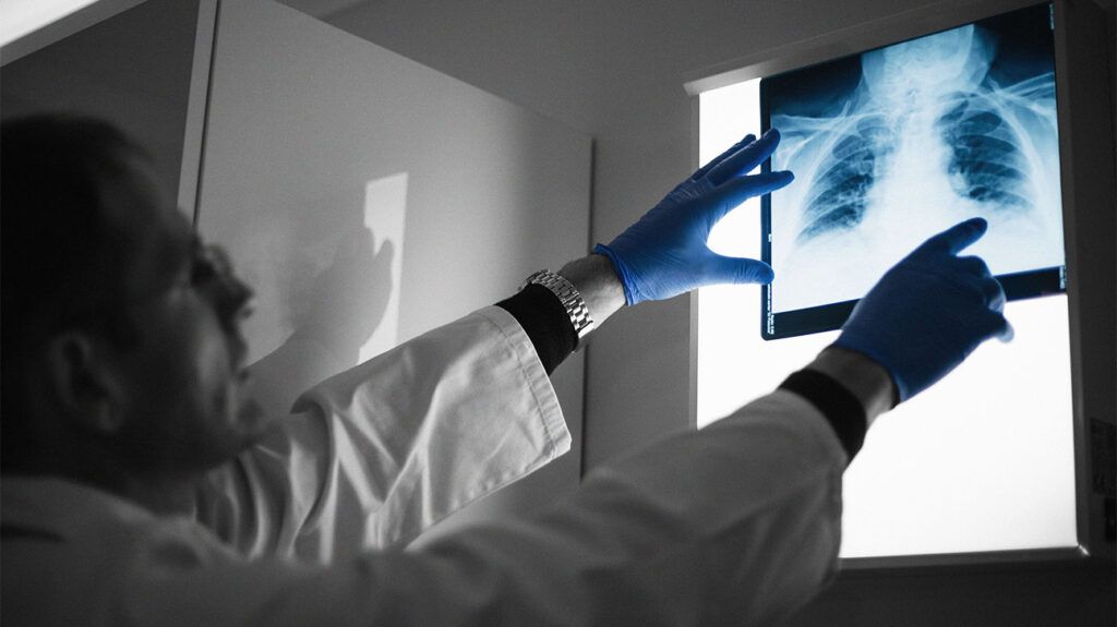 Doctor reviewing an X-ray