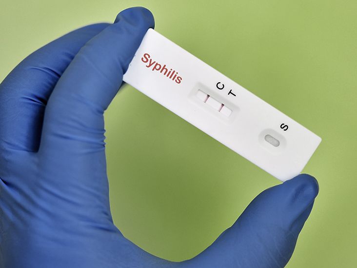 syphilis-false-positive-tests