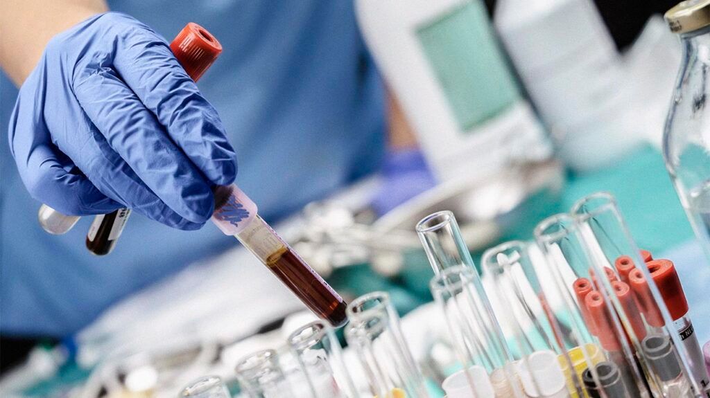 A gloved hand holding a blood sample in a tube and placing among other tubes.