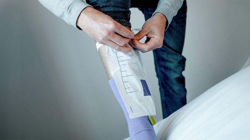 Person attaching a catheter urine drainage bag to leg
