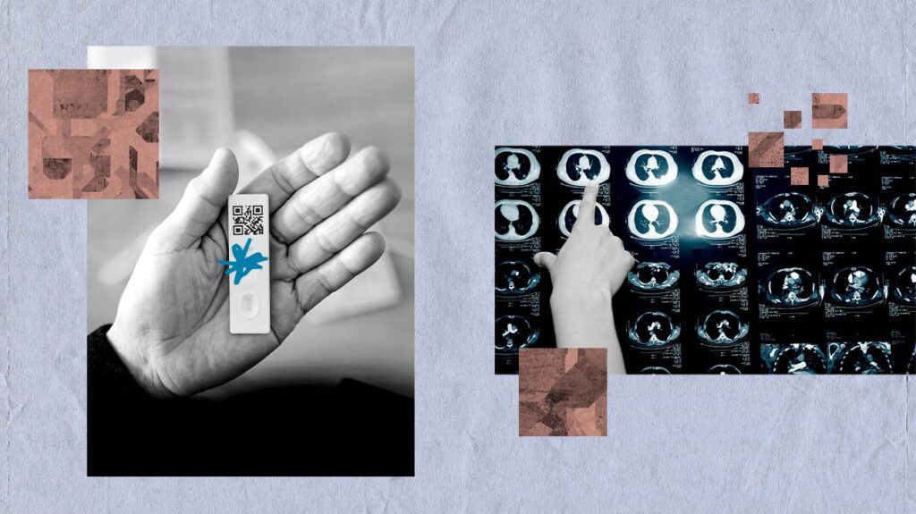 Collage of black and white images including: a person holding a COVID-19 test and a person pointing at a scan