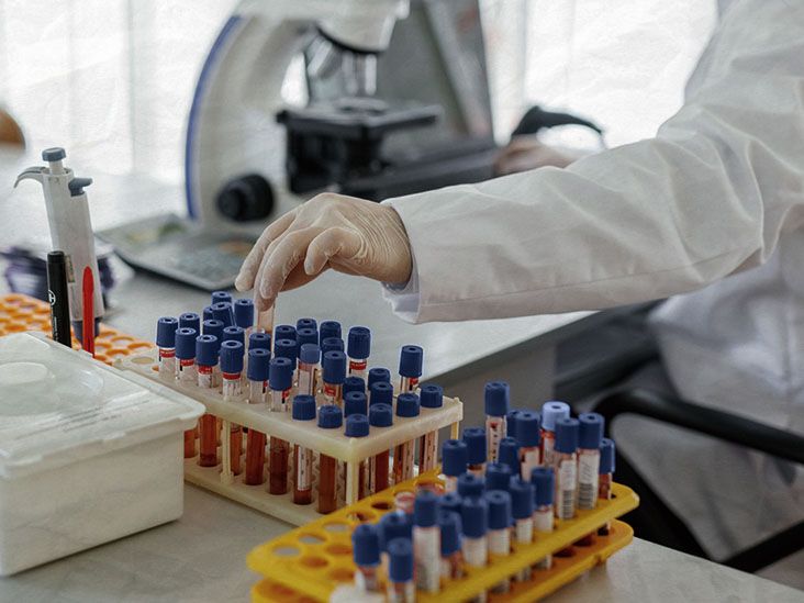 Researchers devise an  blood test
