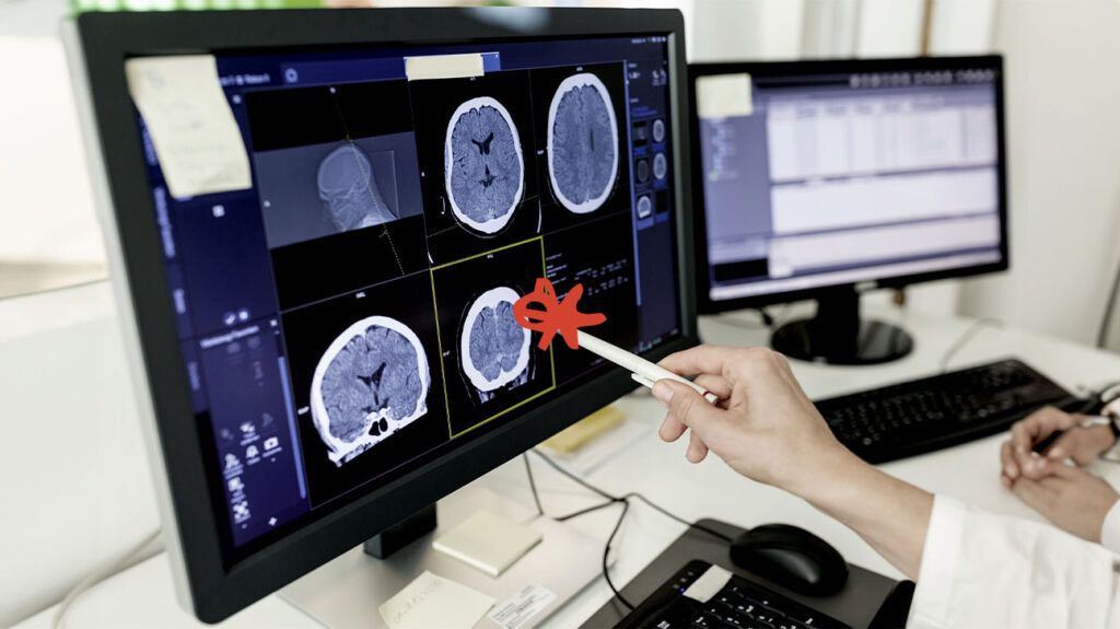 A lab technician uses a pointing pen to examine brain scans on a computer