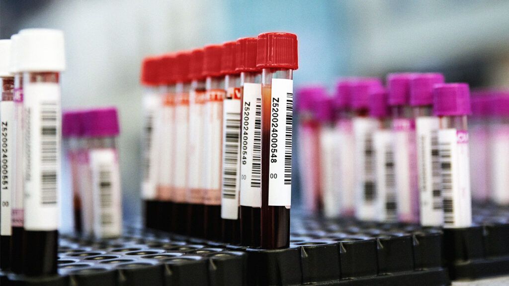 Blood vials in a lab