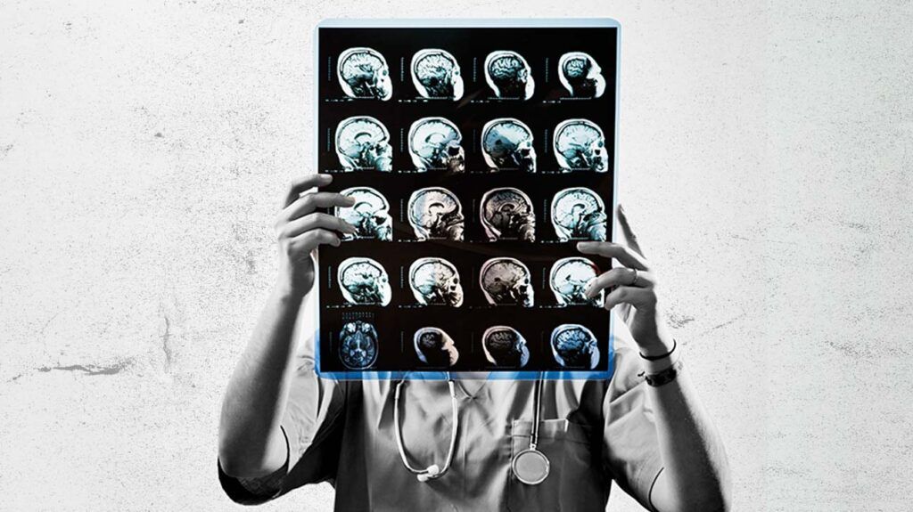 Healthcare professional holding brain scans