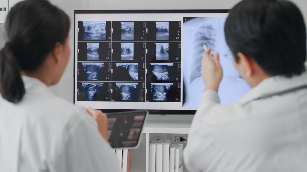 Doctors examining scans to diagnose stage 3 laryngeal cancer -1