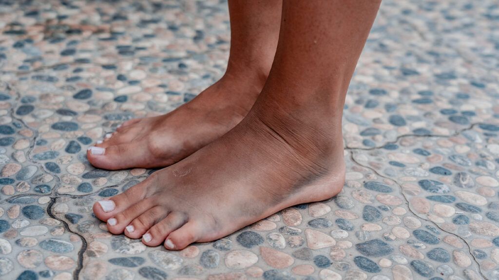 Person with purple feet