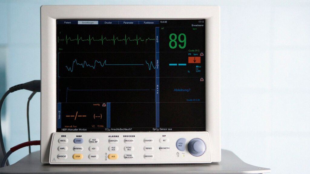 A heart monitor showing ECG results 1