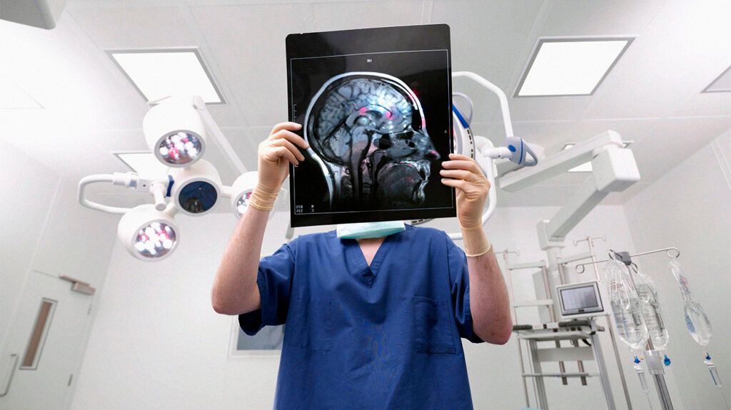 A medical professional holds up an x ray of the human brain in front of their face