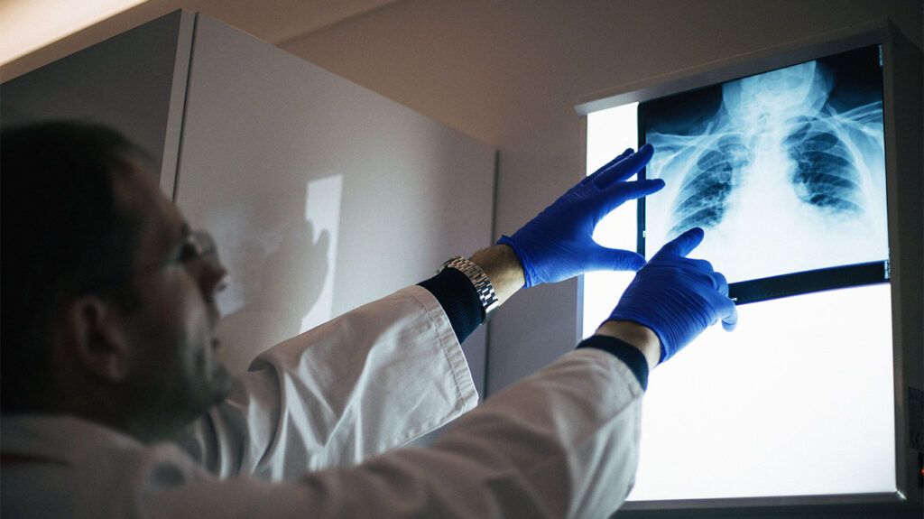 A doctor looking at an X-ray of the lungs -2.