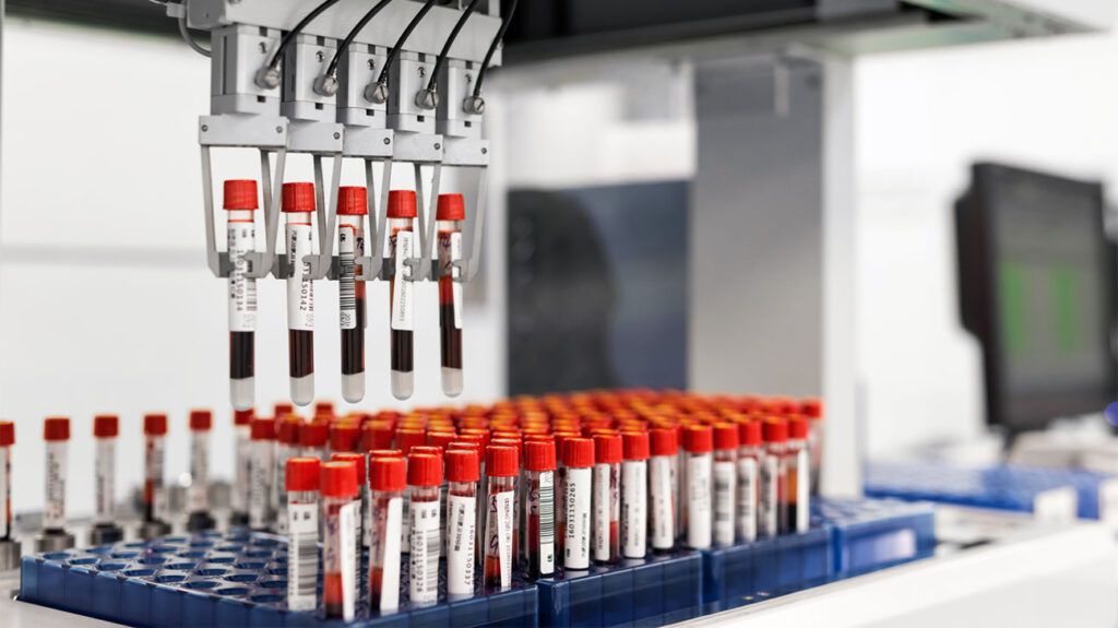 Test tubes full of blood are sitting on a tray, with four of them being lifted up by a machine to get tested.