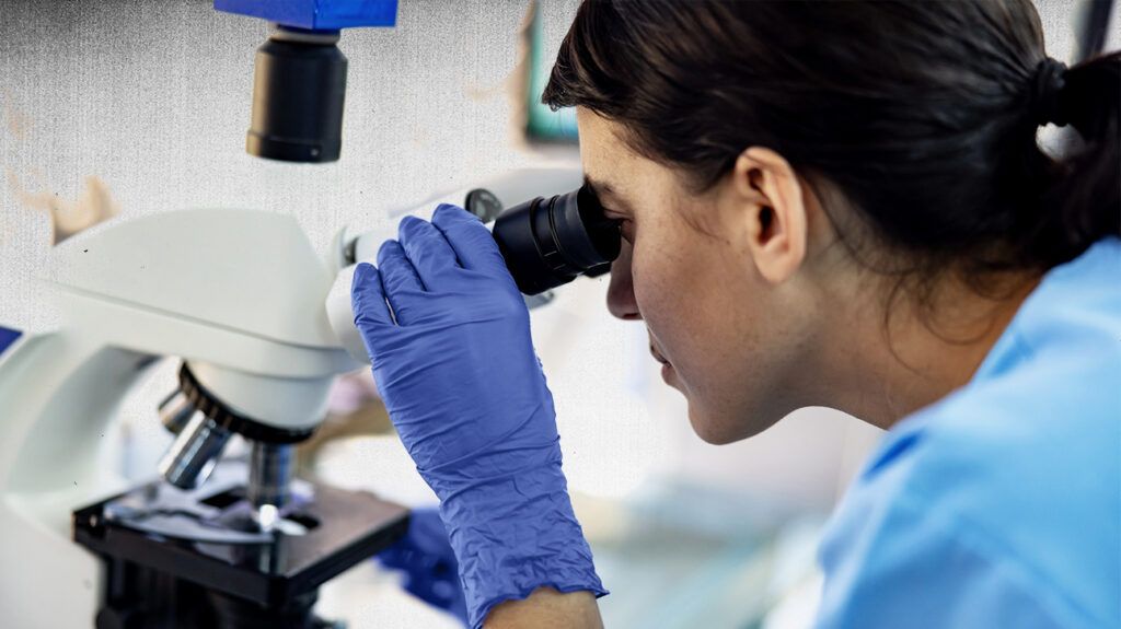 A doctor looking through a microscope to look for markers of Sjögren disease