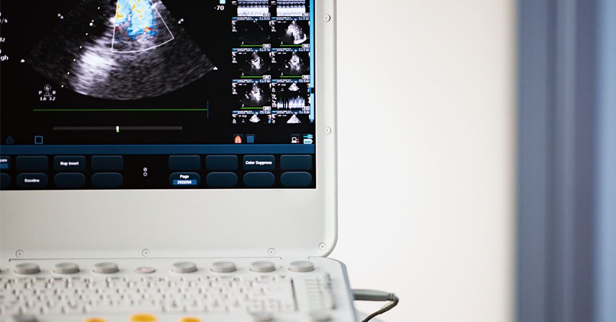 Amyloid heart disease Definition, symptoms, treatment, and outlook