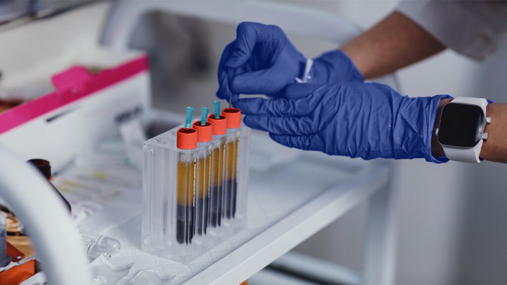 Gloved hands examining blood samples 1