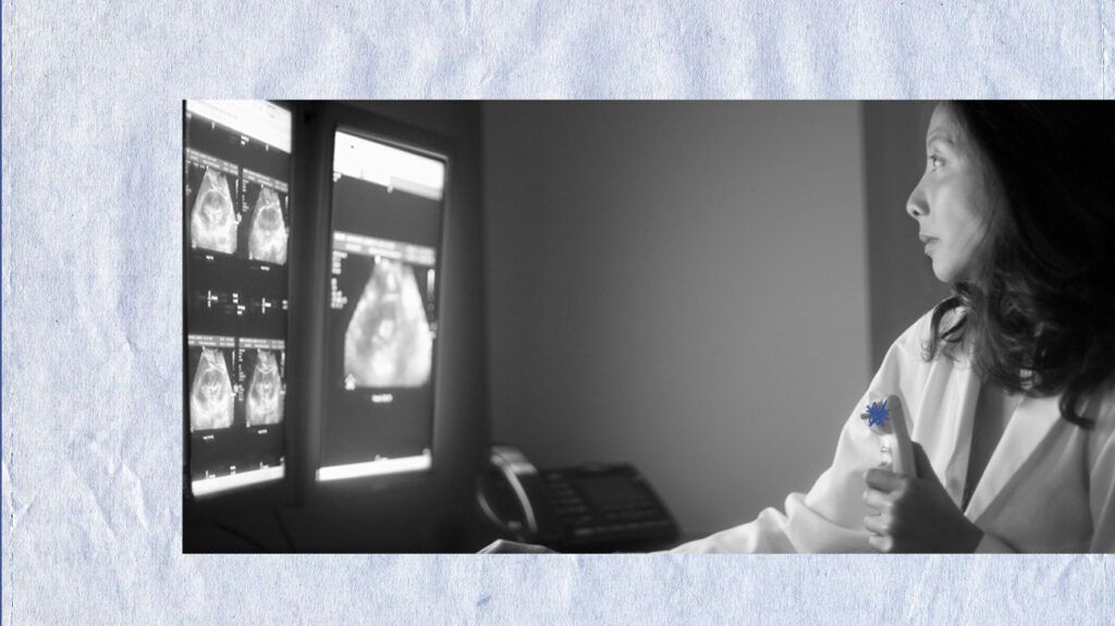 A doctor examining a gallbladder ultrasound for signs of calculous cholecystitis. -2