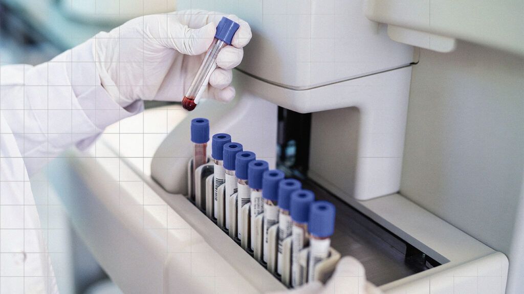 Person's gloved hands in a lab setting holding a blood testing vial