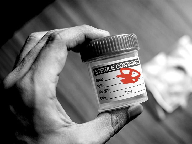 How to collect stool sample at home Tips and more