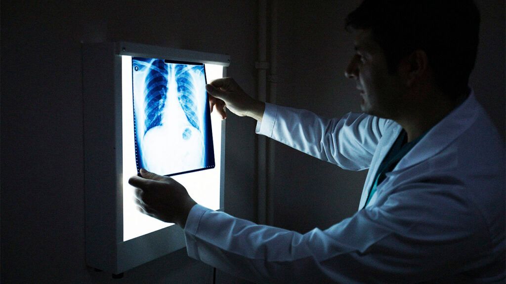 healthcare professional looking at chest x-ray