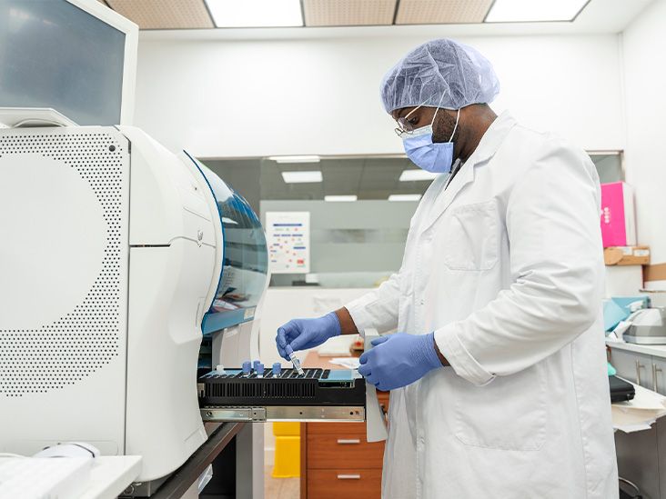 Anemia blood test Overview, levels, tests, and symptoms