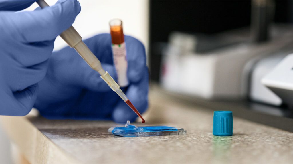 A lab technician preparing a blood sample for a RBC indices test-1.